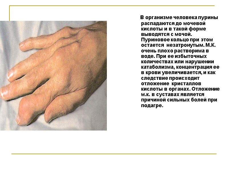 В организме человека пурины распадаются до мочевой кислоты и в такой форме выводятся с